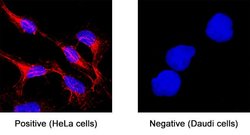 Human L1CAM Antibody, R D Systems 25 &mu;g | Buy Online | R&D Systems | Fisher Scientific