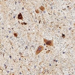 Human/Mouse/Rat MCHR1 Antibody, R D Systems 25 &mu;g; Unconjugated:Antibodies,