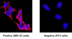 Human MCHR1 Antibody, R D Systems 100 &mu;g; Unconjugated:Antibodies, Monoclonal