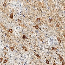 Human MCHR1 Antibody, R D Systems 100 &mu;g; Unconjugated:Antibodies, Monoclonal