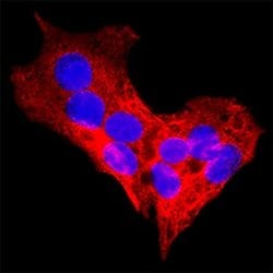 Human Ketohexokinase Antibody, R D Systems 25 &mu;g | Buy Online | R&D Systems | Fisher Scientific