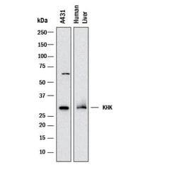 Human Ketohexokinase Antibody, R D Systems 25 &mu;g | Buy Online | R&D Systems | Fisher Scientific
