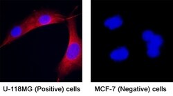 Human GDF-5/BMP-14 Antibody, R D Systems:Antibodies:Primary Antibodies