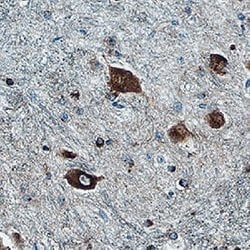 Human Protocadherin gamma C3 Antibody, R D Systems 25 &mu;g; Unconjugated:Antibodies,