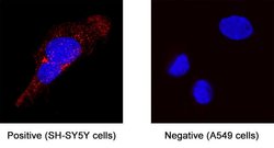 Human beta-1,3-Glucuronyltransferase 1/B3GAT1 Antibody, R D Systems 100