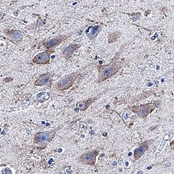 Human beta-1,3-Glucuronyltransferase 1/B3GAT1 Antibody, R D Systems 25