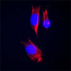 Human EMMPRIN/CD147 Antibody, R D Systems 100 &mu;g | Buy Online | R&D Systems | Fisher Scientific