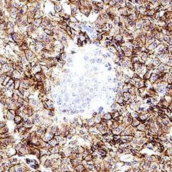 Human EMMPRIN/CD147 Antibody, R D Systems 100 &mu;g | Buy Online | R&D Systems | Fisher Scientific