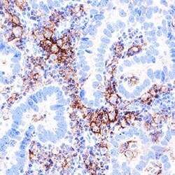 Human P2X7/P2RX7 Antibody, R D Systems:Antibodies:Primary Antibodies