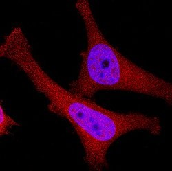 Human p16INK4a/ CDKN2A Antibody, R D Systems 100&mu;g; Unlabeled:Antibodies,