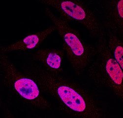 Human p300 Antibody, R D Systems 100&mu;g; Unlabeled:Antibodies, Polyclonal