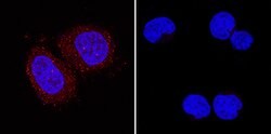 Human/Mouse/Rat p38 gamma Antibody, R D Systems 25&mu;g; Unlabeled:Antibodies,