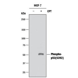 Human Phospho-p53 (S392) Antibody, R D Systems:Antibodies:Primary Antibodies