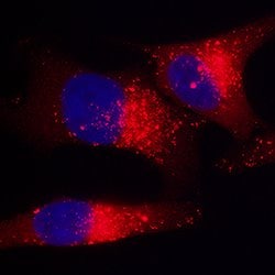 Human/Mouse/Rat p62/SQSTM1 Antibody, R D Systems 25 &mu;g; Unconjgated:Antibodies,