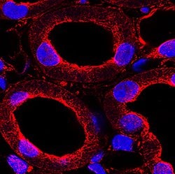 Mouse u-Plasminogen Activator (uPA)/Urokinase Antibody, R D Systems:Antibodies:Primary