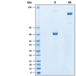 R D Systems Recombinant Human KIR3DL3/CD158z Fc Chimera Protein 50 &mu;g | Buy Online | R&amp;D Systems&trade; | Fisher Scientific