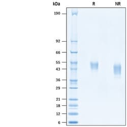 R&D Systems&trade;&nbsp;Recombinant Human LRRC24 His-tag Protein