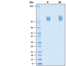 R&D Systems&trade;&nbsp;Recombinant Rat Siglec-2/CD22 His-tag Protein