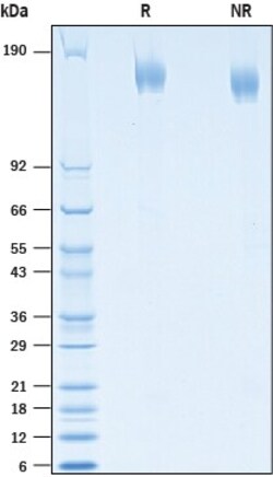 R&D Systems&trade;&nbsp;Recombinant SARS-CoV Spike (GCN4-IZ) His-tag Protein