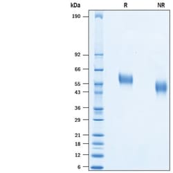 R&D Systems&trade;&nbsp;Recombinant HCoV-HKU1 Spike RBD His-tag Protein