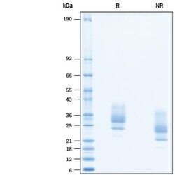 R D Systems Recombinant Human EMMPRIN/CD147 (aa 138-323) His Protein, CF 50 &mu;g | Buy Online | R&amp;D Systems&trade; | Fisher Scientific