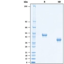 R D Systems Recombinant Cynomolgus Monkey Nectin-2/CD112 His Protein, CF 50 &mu;g | Buy Online | R&amp;D Systems&trade; | Fisher Scientific