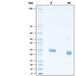 R&D Systems&trade;&nbsp;Recombinant SARS-CoV-2 V367F Spike RBD His-tag Protein