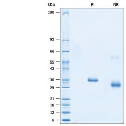 R&D Systems&trade;&nbsp;Recombinant SARS-CoV-2 G476S Spike RBD His-tag Protein