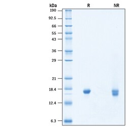 R&D Systems&trade;&nbsp;Recombinant SARS-CoV-2 NSP10 His-tag Protein