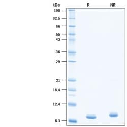 R&D Systems&trade;&nbsp;Recombinant SARS-CoV-2 NSP7 His-tag Protein