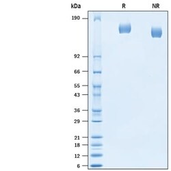 R D Systems Recombinant SARS-CoV-2 Spike (GCN4-IZ) His Protein, CF 100 &mu;g | Buy Online | R&amp;D Systems&trade; | Fisher Scientific