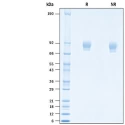 R D Systems Recombinant SARS-CoV-2 K986P V987P Spike S2 (GCN4-IZ) His CF 100 &mu;g | Buy Online | R&amp;D Systems&trade; | Fisher Scientific