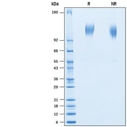 R D Systems Recombinant BatCoV RaTG13 Spike S1 Subunit His Protein, CF 100 &mu;g | Buy Online | R&amp;D Systems&trade; | Fisher Scientific