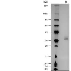 R&D Systems&trade;&nbsp;Recombinant Human B4GalT7 His-tag Protein