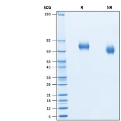 R&D Systems&trade;&nbsp;Recombinant Human Netrin-G2 His-tag Protein