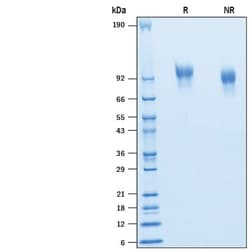 R&D Systems&trade;&nbsp;Recombinant Human PDGF R beta His-tag Protein
