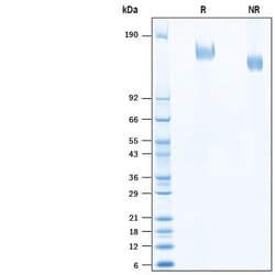 R&D Systems&trade;&nbsp;Recombinant SARS-CoV Spike (GCN4-IZ) His-tag Protein