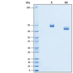 R&D Systems&trade;&nbsp;Recombinant Human Melanotransferrin/CD228 His Protein