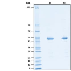 R&D Systems&trade;&nbsp;Recombinant HCoV-229E Nucleocapsid His-tag Protein