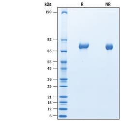 R&D Systems&trade;&nbsp;Recombinant Mouse FLRT2 His-tag Protein