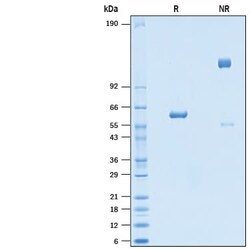 R D Systems Recombinant SARS-CoV-2 B.1.1.7 N501Y Spike RBD Fc Protein 100 &mu;g | Buy Online | R&amp;D Systems&trade; | Fisher Scientific