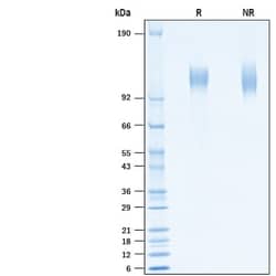 R&D Systems&trade;&nbsp;Recombinant SARS-CoV-2 A222V Spike S1 Subunit His Protein CF