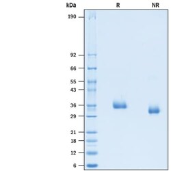 R D Systems Recombinant SARS-CoV-2 B.1.351 Spike RBD His Protein 100 &mu;g | Buy Online | R&amp;D Systems&trade; | Fisher Scientific