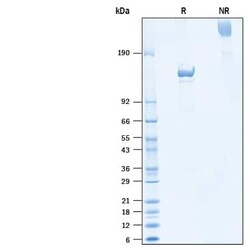 R D Systems Recombinant Human CACHD1 Fc Chimera Protein 50 μg | Buy Online | R&D Systems™ | Fisher Scientific