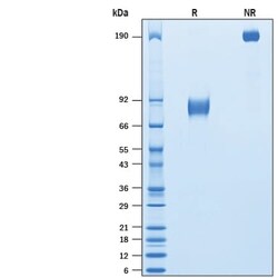 R D Systems Recombinant Mouse IL1RAPL1 Fc Chimera Protein 50 &mu;g | Buy Online | R&amp;D Systems&trade; | Fisher Scientific