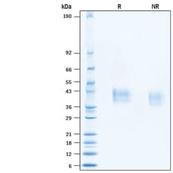 R&D Systems&trade;&nbsp;Recombinant Cynomolgus Mesothelin (aa417-693) His Protein CF