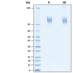 R&D Systems&trade;&nbsp;Recombinant SARS-CoV-2 20A.EU1 S1 Subunit His Protein