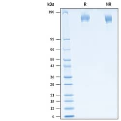 R&D Systems&trade;&nbsp;Recombinant SARS-CoV-2 20C-US Spike His-tag Protein