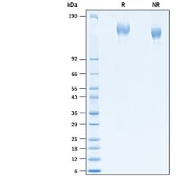 R&D Systems&trade;&nbsp;Recombinant SARS-CoV-2 B.1.351 Spike His-tag Protein