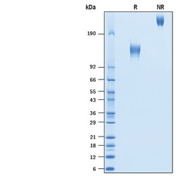 R D Systems Recombinant SARS-CoV Spike S1 Subunit Fc Chimera Protein 100 &mu;g | Buy Online | R&amp;D Systems&trade; | Fisher Scientific